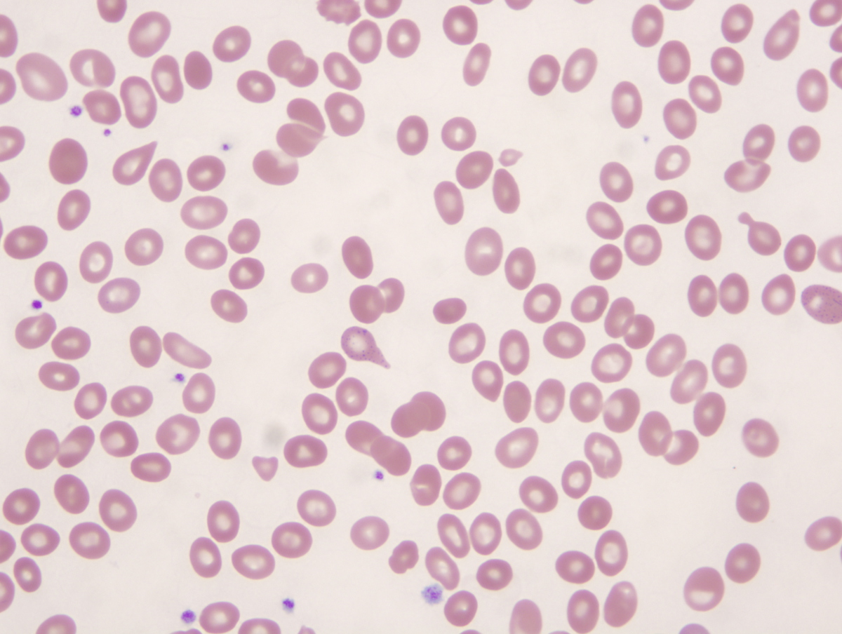 Peripheral blood